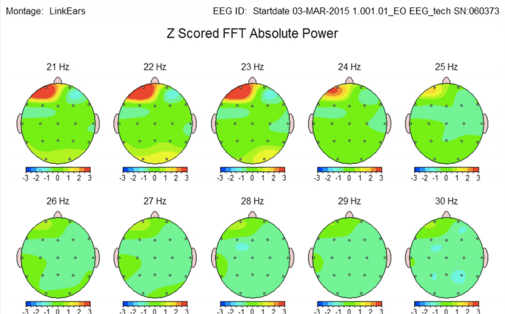 EEG brain scan after Access Bars session