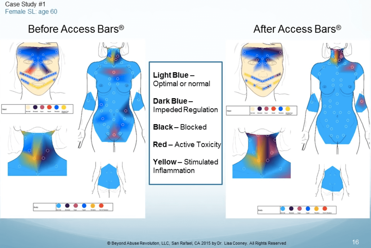 Thermometry scans before and after Access Bars session