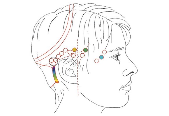 The 32 Points of Access Bars